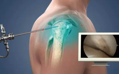 Shoulder Challenge 2026
