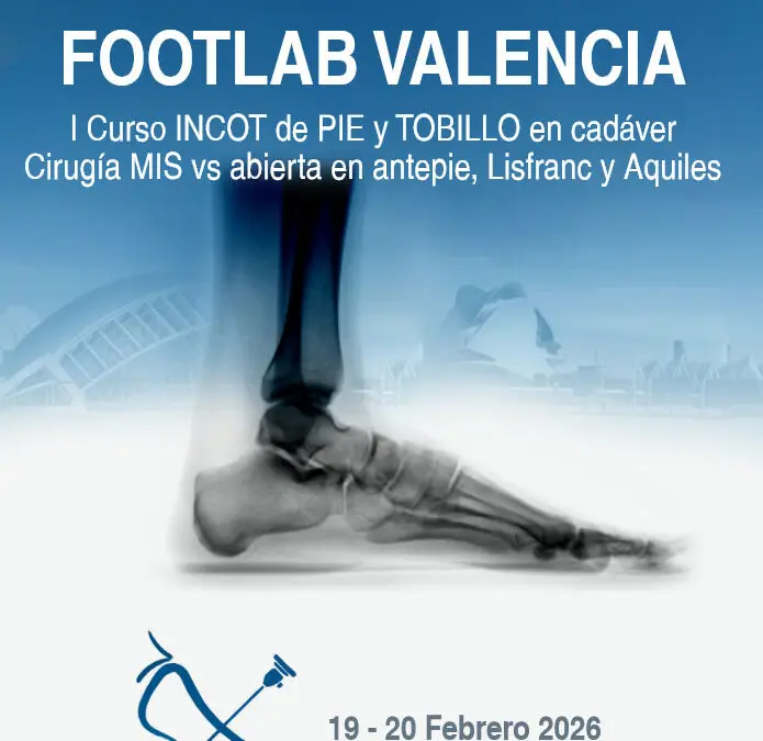 Footlab Valencia
