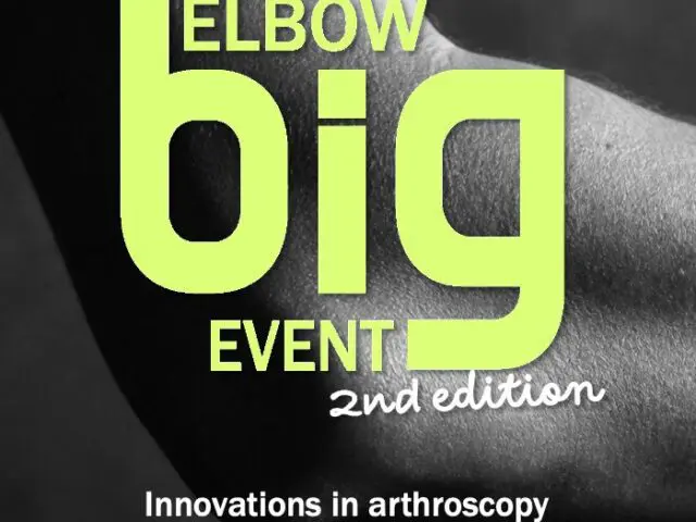 Elbow Big Event 2026